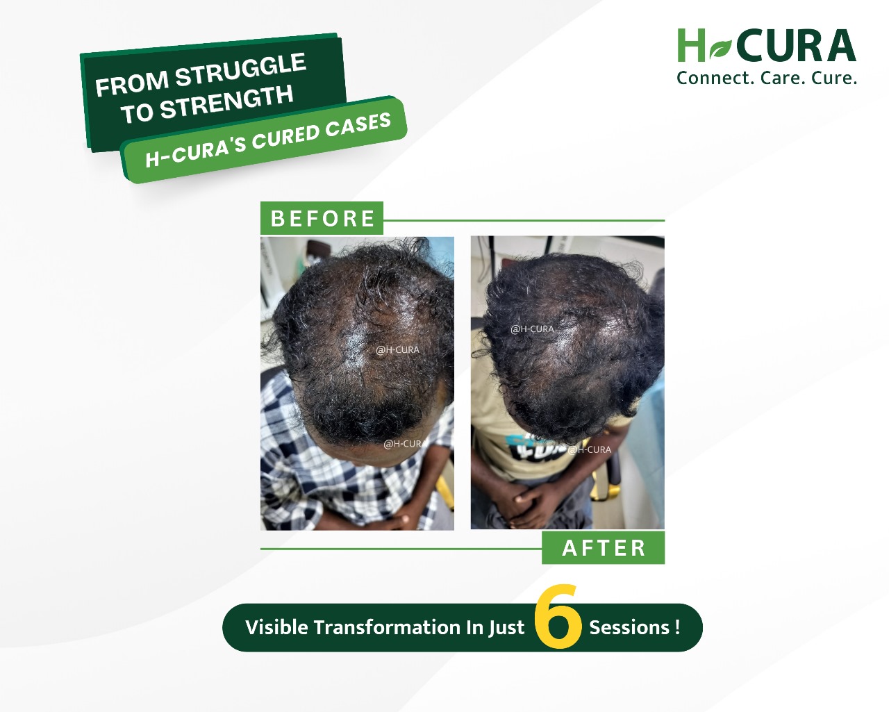 トリートメント CH Treatment Creation Hairs 試してみた】CHトリートメント Josiane Laure(ジョジアンヌ ロール)の